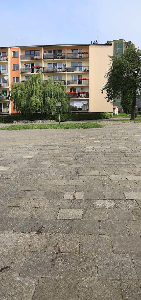 Wypadek dziecka podczas zabawy