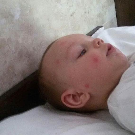 Plaga komarw na prawobrzeu. Karelus: to nie nasze owady