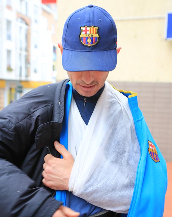 Mia wypadek na skuterze. Mwi, e zama obojczyk i potrzebuje pomocy