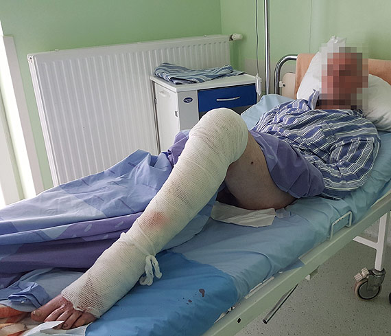 Widok larw zjadających ludzkie ciało, to szpitalna codzienność
