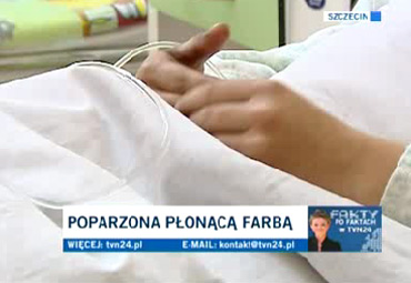 Robotnik podpalił dziewczynkę