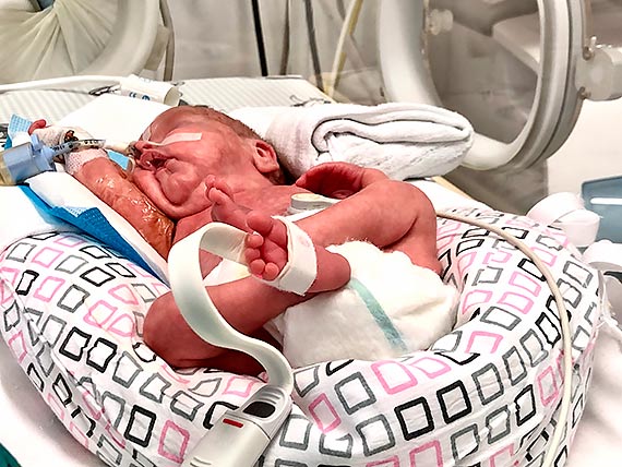 Pół kilograma szczęścia to zawsze wielkie wyzwanie 17 listopada - Światowy Dzień Wcześniaka