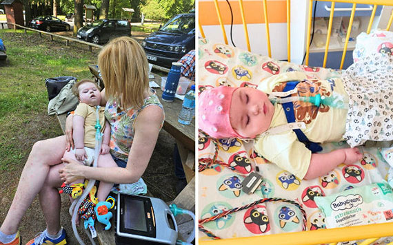 Ekstremalnie rzadki zesp Retta u chopca! Wojtu ze winoujcia yje wbrew statystykom