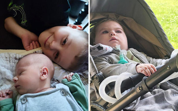 Ekstremalnie rzadki zesp Retta u chopca! Wojtu ze winoujcia yje wbrew statystykom